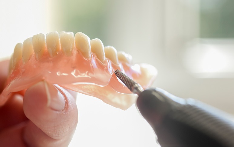 Denture Process | Point McKay Dental | General & Family Dentist | NW Calgary