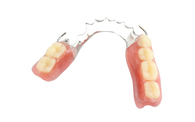 Dentures | Point McKay Dental | General & Family Dentist | NW Calgary