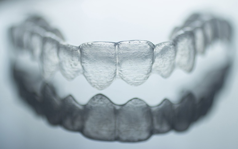 NW Calgary Invisalign, Invisible Braces