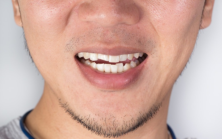Orthodontics | Point McKay Dental | General & Family Dentist | NW Calgary