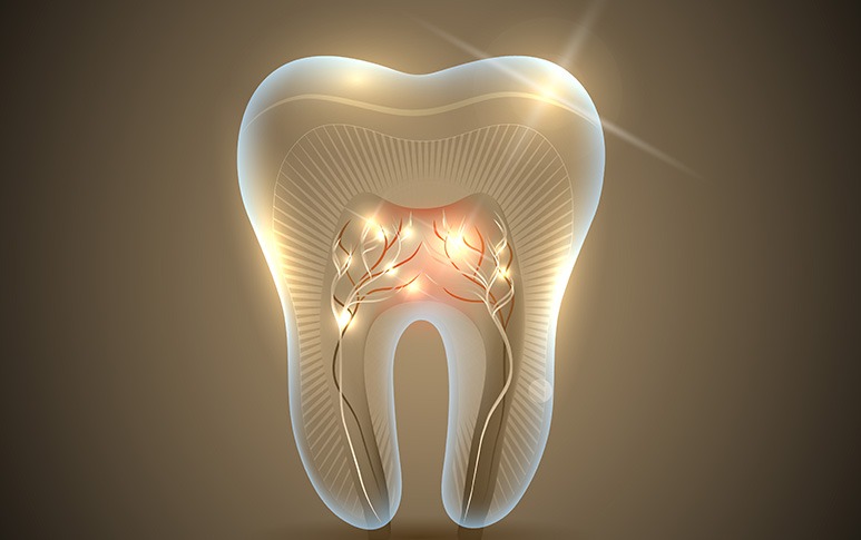 Root Canal Myths | Point McKay Dental | General & Family Dentist | NW Calgary