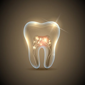 Root Canal Therapy | Point McKay Dental | General & Family Dentist | NW Calgary