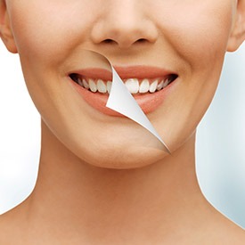 Teeth Whitening | Point McKay Dental | General & Family Dentist | NW Calgary